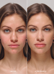 Before and after comparison of a woman's  rosacea face with 'Before' on the left and 'After Shade 02' on the right, wearing acne-safe skin tint