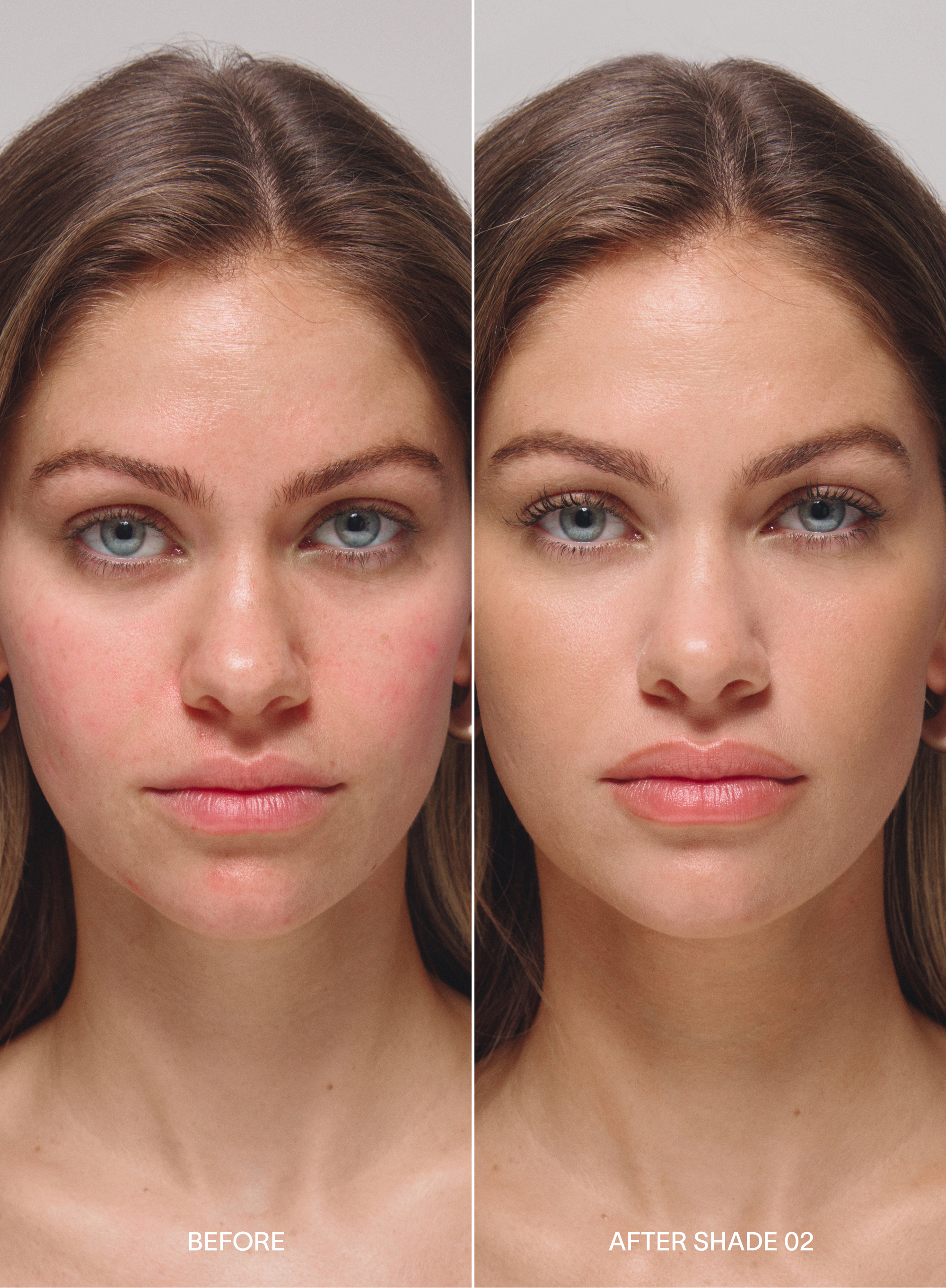 Before and after comparison of a woman's  rosacea face with 'Before' on the left and 'After Shade 02' on the right, wearing acne-safe skin tint