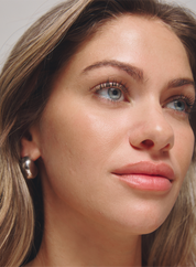 Close-up of a woman's face with acne scars