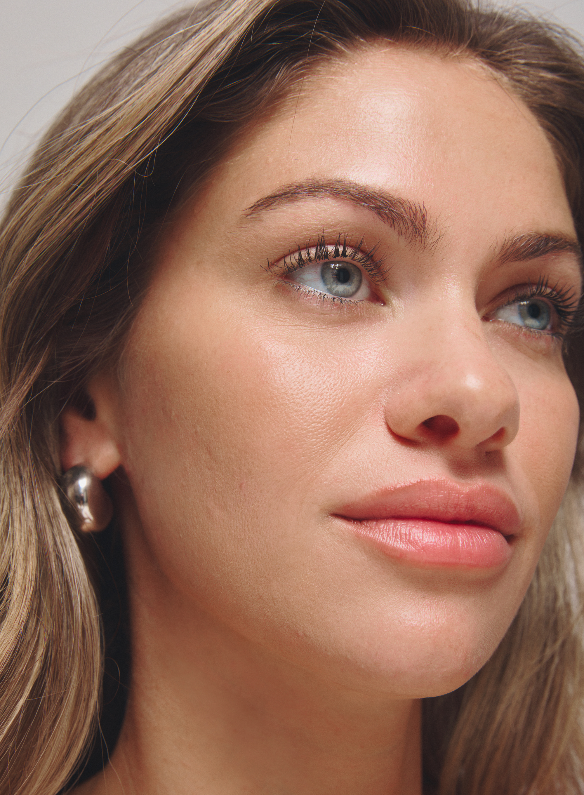 Close-up of a woman's face with acne scars