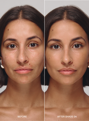 Before and after comparison of a woman's face with 'Before' on the left and 'After Shade 04' on the right, wearing acne-safe skin tint