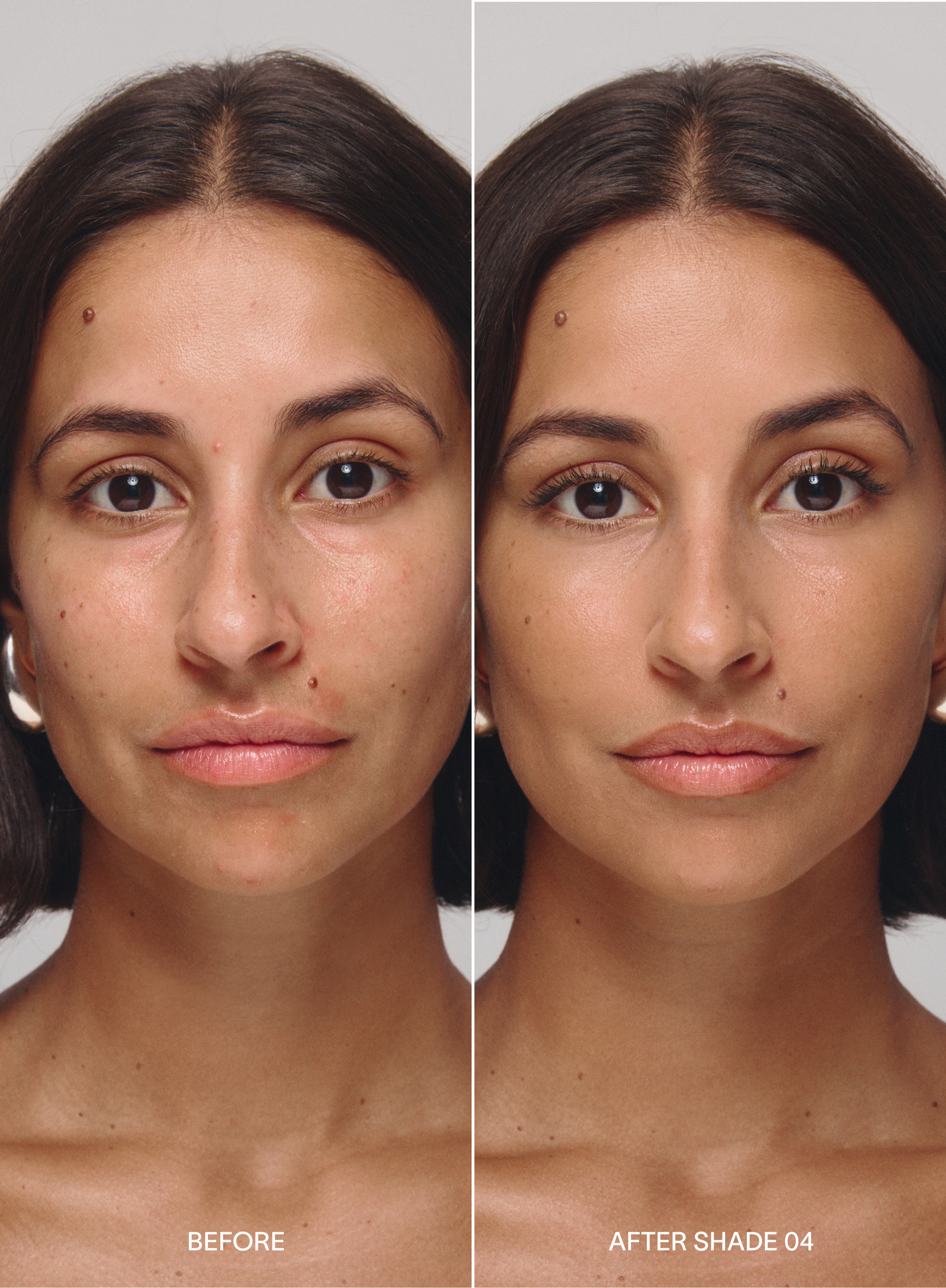 Before and after comparison of a woman's face with 'Before' on the left and 'After Shade 04' on the right, wearing acne-safe skin tint