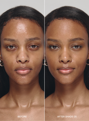 Before and after comparison of a woman's face with 'Before' on the left and 'After Shade 05' on the right, wearing acne-safe skin tint